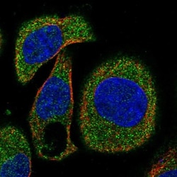 OSTF1 Antibody, Novus Biologicals:Antibodies:Primary Antibodies